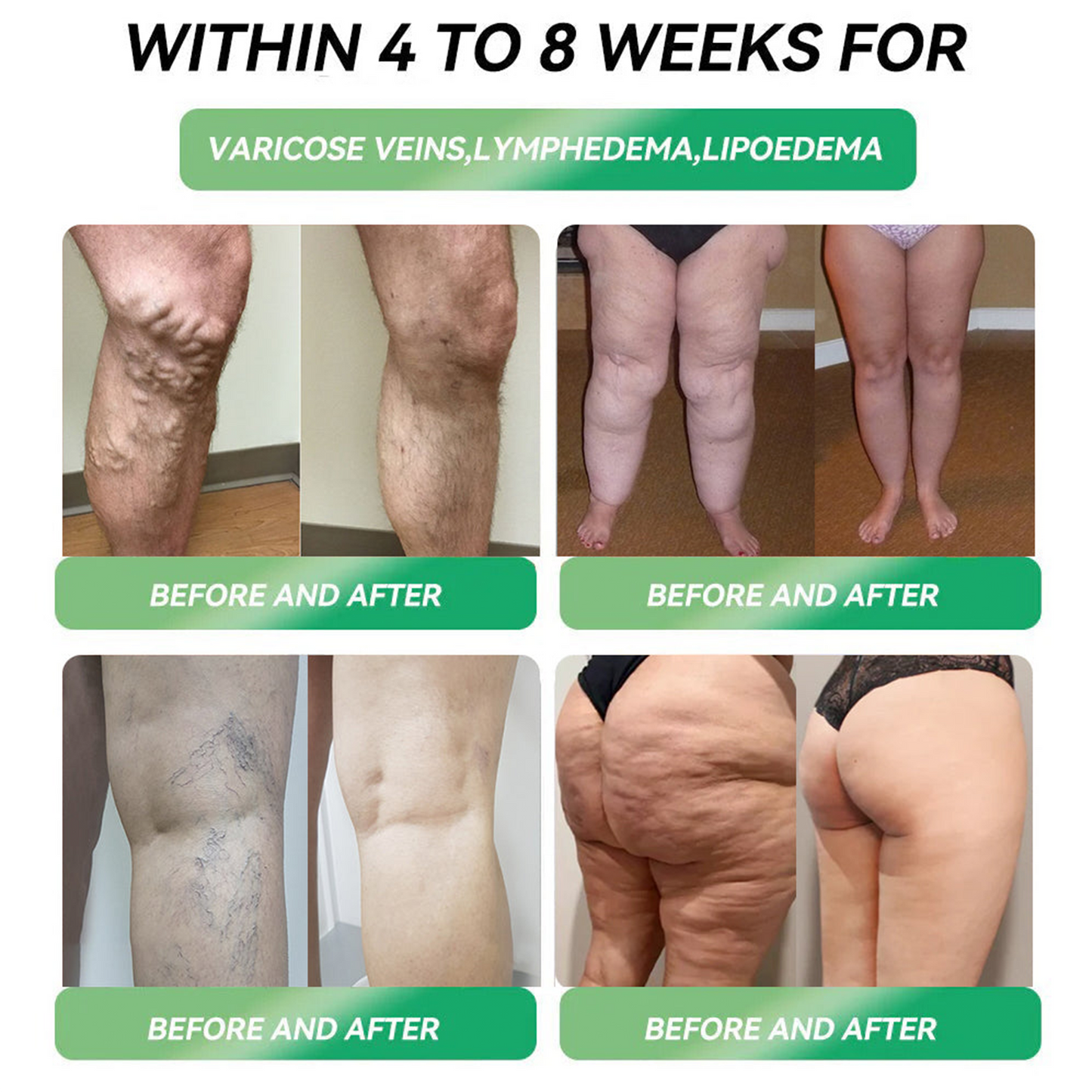 | 🎄Último día – 80% de descuento | 🇺🇲🏥 Cleansing® Líquido de salud seis en uno 💧 Diario ✅ Peso ⚖️, Corazón ❤️, Metabolismo 🔄, Sueño 💤, Digestión 🌿, Articulaciones 🤸 y Vitalidad 🌟 – ¡Resultados notables en 7 días! ✅