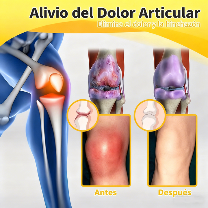 Alivio para huesos y articulaciones con veneno de abeja — 🔥70 % de descuento por tiempo limitado🔥