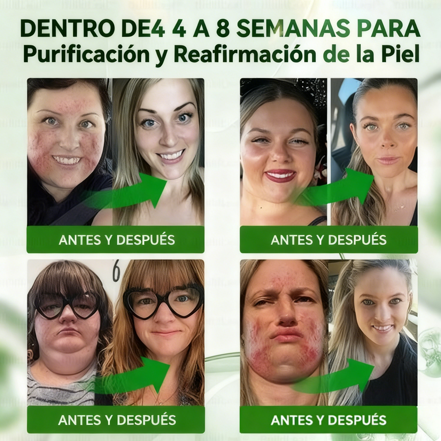 Cleansing® 𝑮𝑳𝑷-1 𝑮𝒖𝒕 𝑪𝒍𝒆𝒂𝒏𝒔𝒆 𝒂𝒏𝒅 𝑺𝒍𝒊𝒎 𝑺𝒖𝒑𝒑𝒐𝒓𝒕 𝑭𝒐𝒓𝒎𝒖𝒍𝒂 (𝐎𝐧𝐜𝐞 𝐚 𝐝𝐚𝐲, 𝐫𝐞𝐬𝐮𝐥𝐭𝐬 𝐢𝐧 𝟕 𝐝𝐚𝐲𝐬) 𝑾𝒊𝒕𝒉 10 𝑩𝒊𝒍𝒍𝒊𝒐𝒏 𝑪𝑭𝑼 𝑨𝒄𝒕𝒊𝒗𝒆 𝑷𝒓𝒐𝒃𝒊𝒐𝒕𝒊𝒄𝒔, 𝑺𝒖𝒑𝒑𝒐𝒓𝒕𝒔 𝒘𝒆𝒊𝒈𝒉𝒕 𝒎𝒂𝒏𝒂𝒈𝒆𝒎𝒆𝒏𝒕, 𝒉𝒆𝒂𝒓𝒕 𝒉𝒆𝒂𝒍𝒕𝒉, 𝒅𝒊𝒂𝒃𝒆𝒕𝒆𝒔, 𝒈𝒖𝒕 & 𝒘𝒐𝒎𝒆𝒏'𝒔 𝒉𝒆𝒂𝒍𝒕𝒉, 𝒇𝒊𝒓𝒎𝒊𝒏𝒈 𝒔𝒌𝒊𝒏,𝒘𝒉𝒊𝒍𝒆 𝒔𝒆𝒂𝒔𝒐𝒏𝒂𝒍 𝒊𝒎𝒎𝒖𝒏𝒆 𝒔𝒖𝒑𝒑𝒐𝒓𝒕