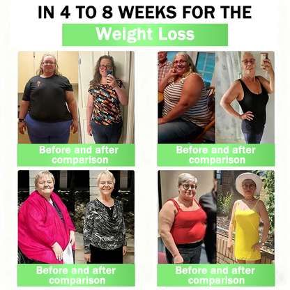 Cleansing® GLP-1 20-in-1 Weight Loss Supplement (Visible Results in 7 Days) helps improve obesity, cardiovascular health, diabetes, gut health, joint problems, firmer skin, and increased energy.