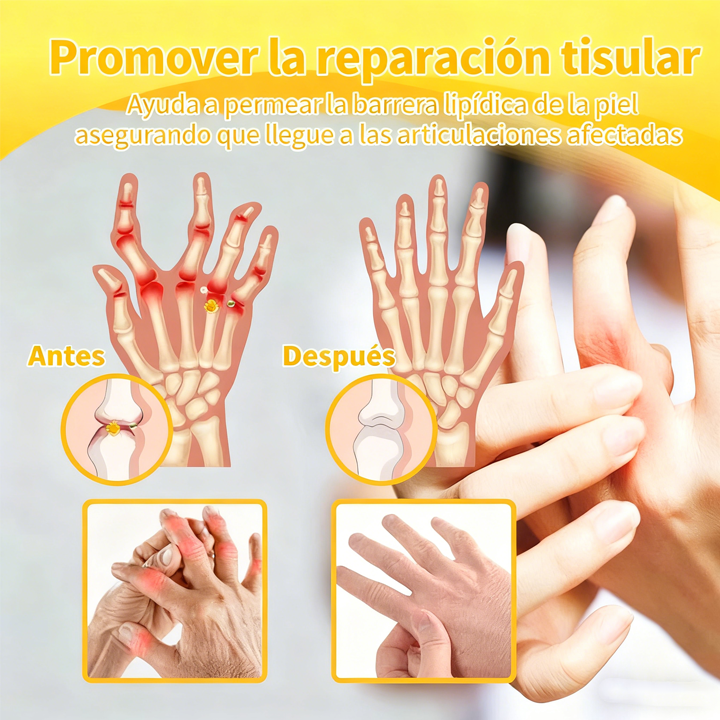 Alivio para huesos y articulaciones con veneno de abeja — 🔥70 % de descuento por tiempo limitado🔥