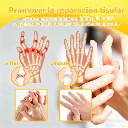 Alivio para huesos y articulaciones con veneno de abeja — 🔥70 % de descuento por tiempo limitado🔥